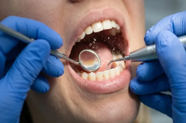 General Dentistry Strategies That Save You Money In The Long Run
